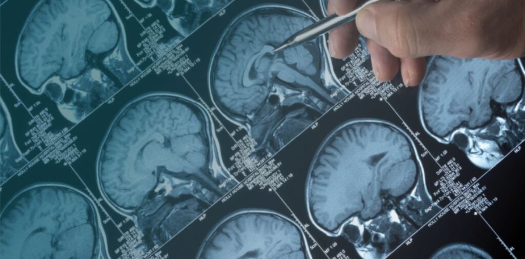 Understanding-Seizures-and-How-to-Help